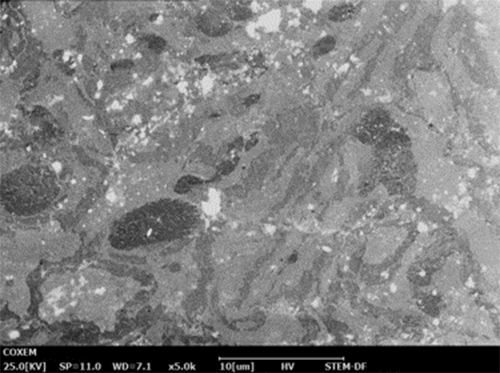 颜色癌细胞的茎图像