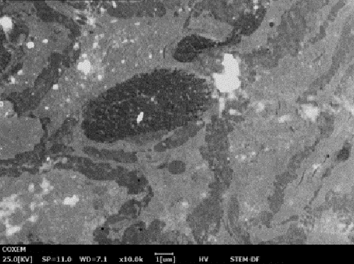 彩色癌细胞的干细胞图像