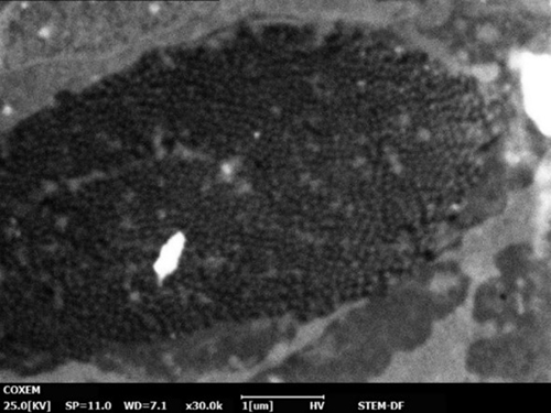 彩色癌细胞的干细胞图像