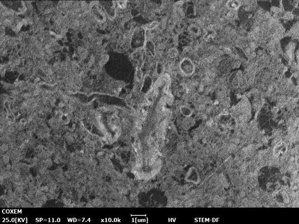 神经元细胞的干细胞图像