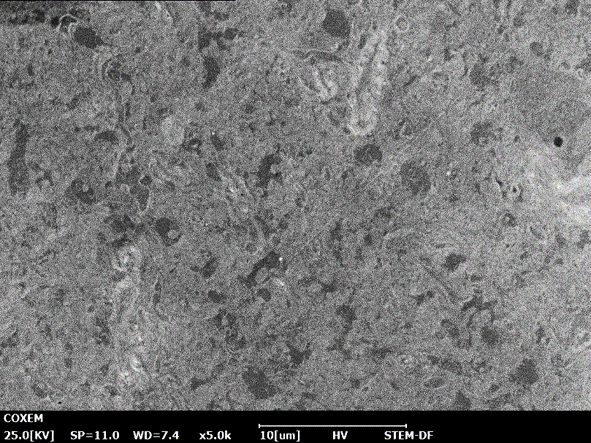 神经元细胞的干细胞图像